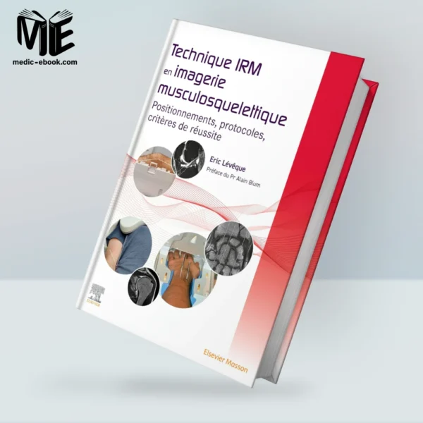 Technique IRM en imagerie musculosquelettique: Positionnements, protocoles, critères de réussite (Original PDF from Publisher)