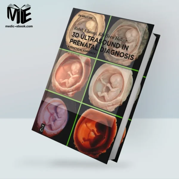 3D Ultrasound in Prenatal Diagnosis: A Practical Approach, 2nd edition