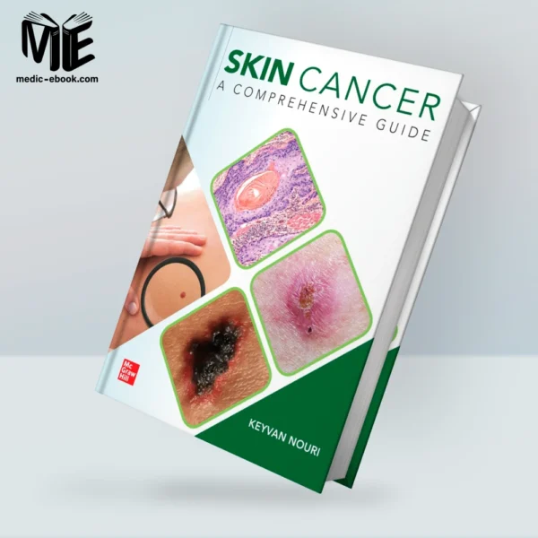 Skin Cancer: A Comprehensive Guide (Original PDF from Publisher)