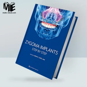 Zygoma Implants: Step by Step (Original PDF from Publisher)