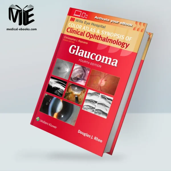 Glaucoma_ Color Atlas and Synopsis of Clinical Ophthalmology, 4th | EPUB+PDF