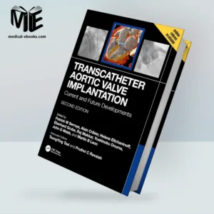 Transcatheter Aortic Valve Implantation: Current and Future Developments, 2nd edition