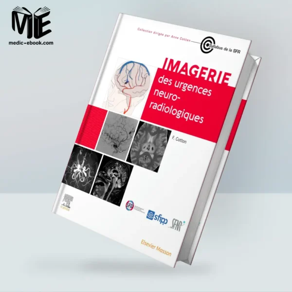 Imagerie des urgences neuroradiologiques (True PDF from Publisher)